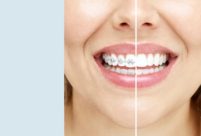 Dental Smile Treatment Options