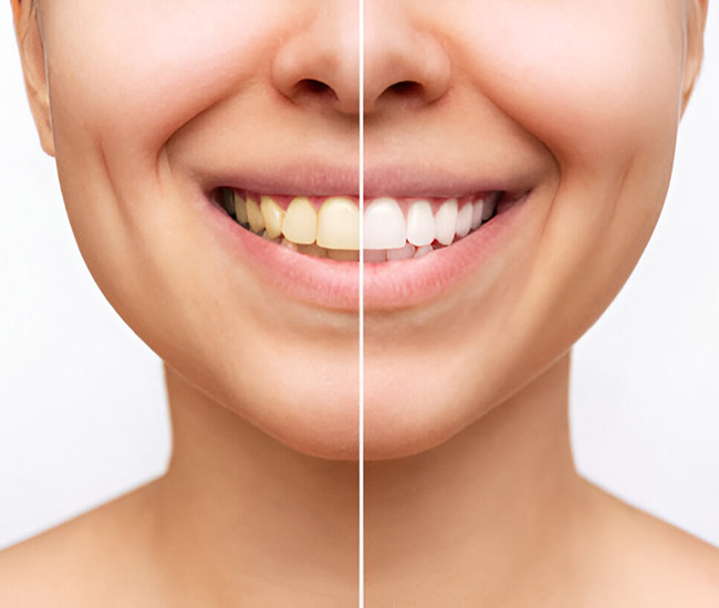 The Best Natural Ways to Whiten Your Teeth