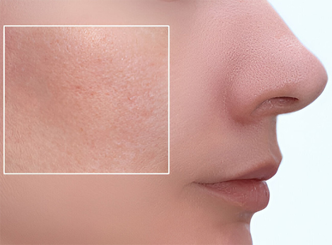 Understanding Pore-Clogging Ingredients